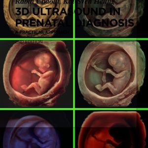 3D Ultrasound in Prenatal Diagnosis – A Practical Approach, 2nd Edition (EPUB)