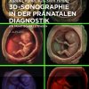 3D-Sonographie in der pränatalen Diagnostik: Ein praktischer Leitfaden, 2nd Edition (Original PDF from Publisher)