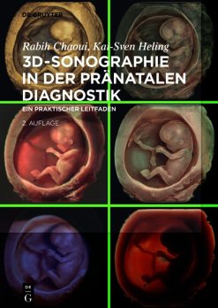 3D-Sonographie in der pränatalen Diagnostik: Ein praktischer Leitfaden, 2nd Edition (EPUB)