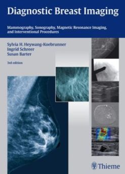 Diagnostic Breast Imaging: Mammography, Sonography, Magnetic Resonance Imaging, and Interventional Procedures, 3rd Edition