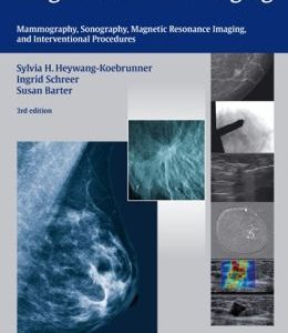 Diagnostic Breast Imaging: Mammography, Sonography, Magnetic Resonance Imaging, and Interventional Procedures, 3rd Edition