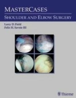 MasterCases: Shoulder and Elbow Surgery