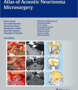 Atlas of Acoustic Neurinoma Microsurgery, 2nd Edition