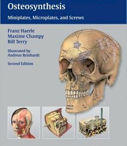 Atlas of Craniomaxillofacial Osteosynthesis: Microplates, Miniplates, and Screws, 2nd Edition