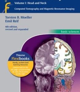 Pocket Atlas of Sectional Anatomy, Volume I: Head and Neck: Computed Tomography and Magnetic Resonance Imaging, 4th Edition (EPUB)