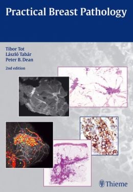 Practical Breast Pathology, 2nd Edition (Original PDF from Publisher)