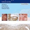 Burghardt’s Primary Care Colposcopy: Textbook and Atlas, 2nd Edition (EPUB)