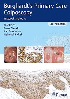 Burghardt’s Primary Care Colposcopy: Textbook and Atlas, 2nd Edition (EPUB)