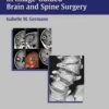Advanced Techniques in Image-Guided Brain and Spine Surgery