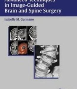 Advanced Techniques in Image-Guided Brain and Spine Surgery