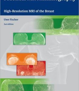 Practical MR Mammography: High-Resolution MRI of the Breast (ORIGINAL PDF from Publisher)