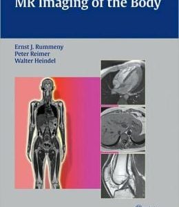 MR Imaging of the Body