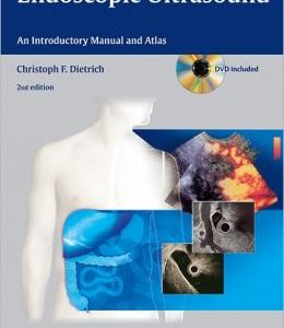 Endoscopic Ultrasound: An Introductory Manual and Atlas