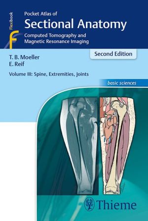 Pocket Atlas of Sectional Anatomy, Volume 3: Spine, Extremities, Joints: Computed Tomography and Magnetic Resonance Imaging (EPUB)