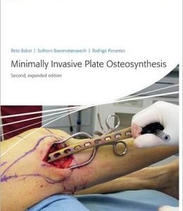 Minimally Invasive Plate Osteosynthesis (MIPO) (ORIGINAL PDF from Publisher)