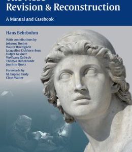 The Nose – Revision and Reconstruction: A Manual and Casebook (ORIGINAL PDF from Publisher)