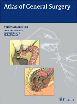 Atlas of General Surgery (Original PDF from Publisher)