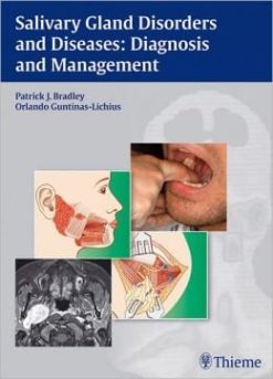 Salivary Gland Disorders and Diseases: Diagnosis and Management
