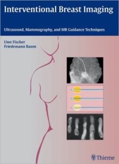 Interventional Breast Imaging: Ultrasound, Mammography, and MR Guidance Techniques