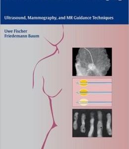 Interventional Breast Imaging: Ultrasound, Mammography, and MR Guidance Techniques