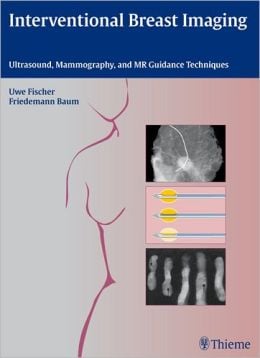 Interventional Breast Imaging: Ultrasound, Mammography, and MR Guidance Techniques