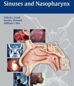 Tumors of the Nose, Sinuses and Nasopharynx (ORIGINAL PDF from Publisher)