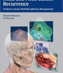 Head and Neck Cancer Recurrence: Evidence-Based, Multidisciplinary Management (ORIGINAL PDF from Publisher)