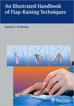 An Illustrated Handbook of Flap-Raising Techniques