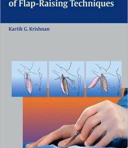 An Illustrated Handbook of Flap-Raising Techniques