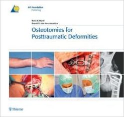 Osteotomies for Posttraumatic Deformities (ORIGINAL PDF from Publisher)