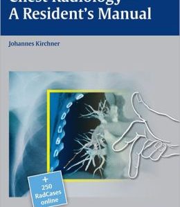 Chest Radiology– A Resident’s Manual (ORIGINAL PDF from Publisher)