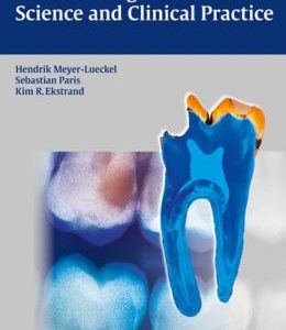 Caries Management – Science and Clinical Practice (ORIGINAL PDF from Publisher)