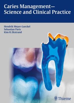 Caries Management – Science and Clinical Practice (ORIGINAL PDF from Publisher)
