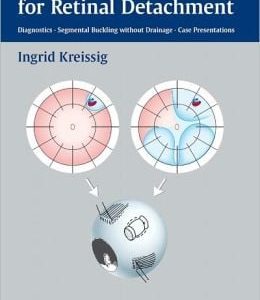 A Practical Guide to Minimal Surgery for Retinal Detachment, Volume 1