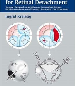 A Practical Guide to Minimal Surgery for Retinal Detachment, Volume 2
