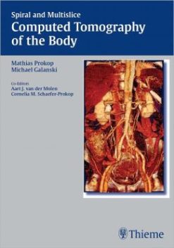 Spiral and Multislice Computed Tomography of the Body
