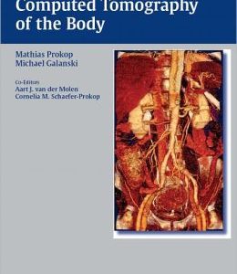 Spiral and Multislice Computed Tomography of the Body
