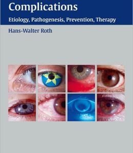 Contact Lens Complications