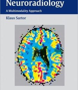 Diagnostic and Interventional Neuroradiology
