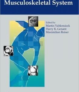 MRI of the Musculoskeletal System