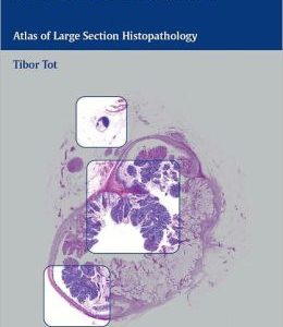 Colorectal Tumors: Atlas of Large Section Histopathology