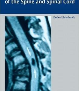 MR Imaging of the Spine and Spinal Cord