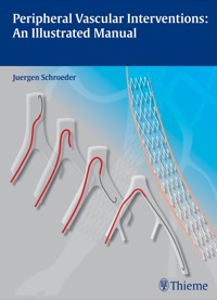 Peripheral Vascular Interventions: An Illustrated Manual (Original PDF from Publisher)