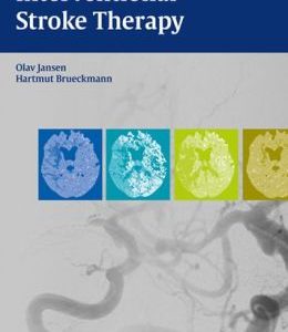 Interventional Stroke Therapy (ORIGINAL PDF from Publisher)