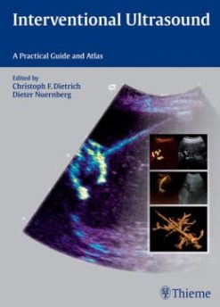 Interventional Ultrasound: A Practical Guide and Atlas (ORIGINAL PDF from Publisher)