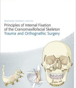 Principles of Internal Fixation of the Craniomaxillofacial Skeleton (Original PDF from Publisher)
