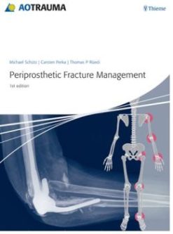 Periprosthetic Fracture Management (ORIGINAL PDF from Publisher)