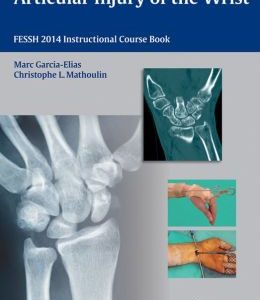 Articular Injury of the Wrist: FESSH 2014 Instructional Course Book (ORIGINAL PDF from Publisher)