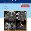 Neurosonology and Neuroimaging of Stroke: A Comprehensive Reference, 2nd Edition (PDF)