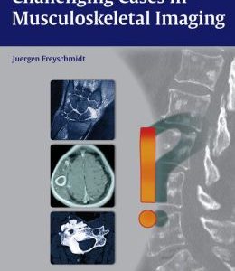 Challenging Cases in Musculoskeletal Imaging